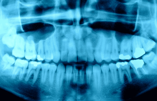 dental xray