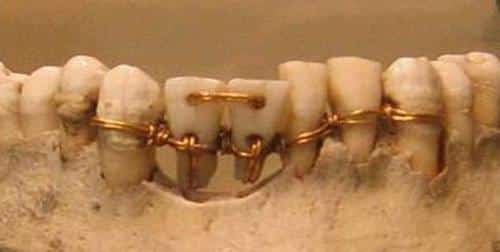 these teeth pre-date the Roman Empire.