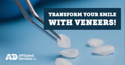Transform your smile with veneers