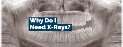 Why do I need x - rays?