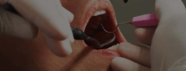 Dentist looking inside a person's mouth looking for oral cancer