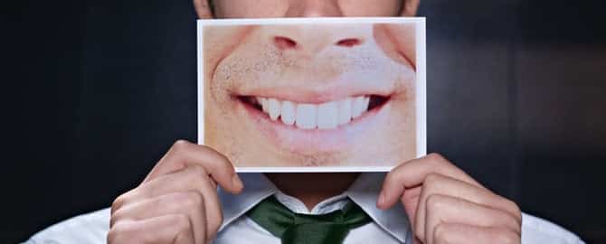 Man with clean teeth image