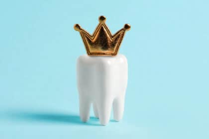 Dental Crown Madison